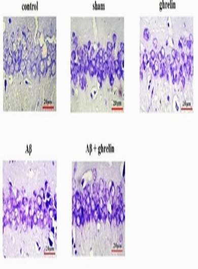 The effect of ghrelin on antioxidant status in the rats model of Alzheimers disease induced by amyloid beta
